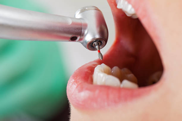 Best Root Canal Emergency Dentist  in Mundelein, IL